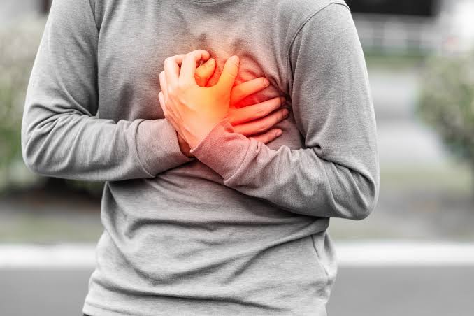 Heart Attack Treatment