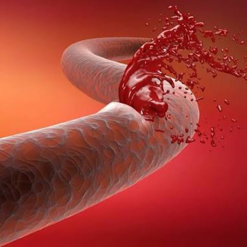 HEMOPHILIA
